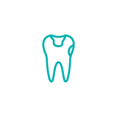 Зъбен камък