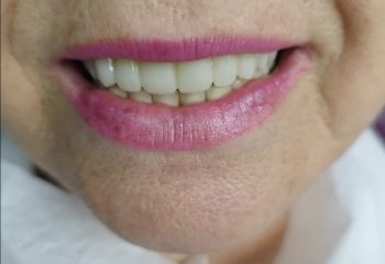 73г пациентка, лечението извършено от д-р Койнов Медента Плевен