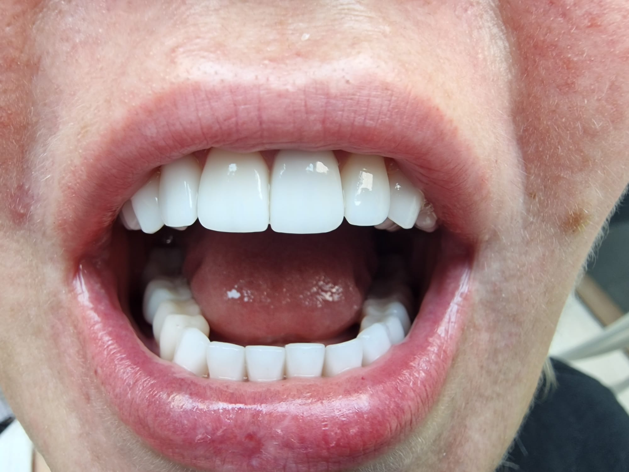 Случай на пациента преди и след лечението.